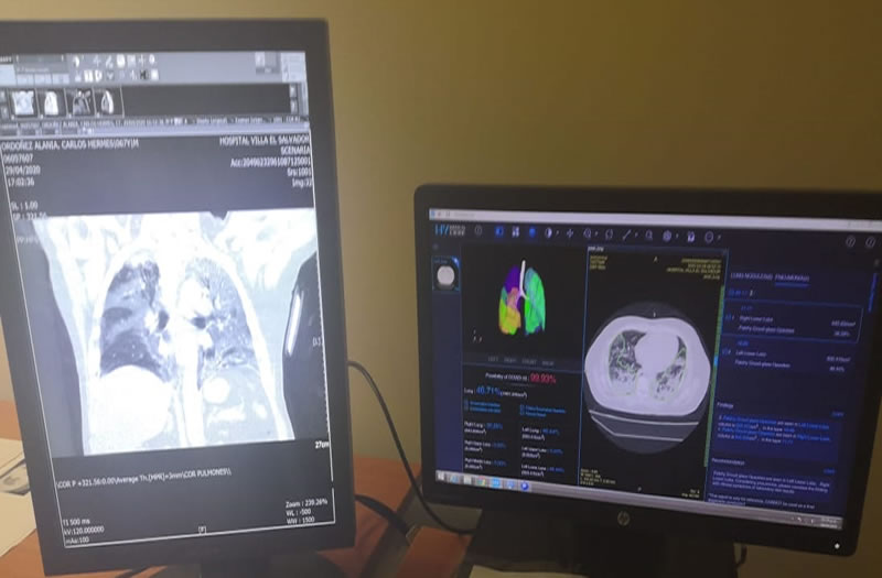 Huawei dona al Hospital Villa El Salvador  plataforma con IA para diagnostico COVID-19